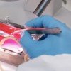 Scientists Use 3D Printer to Create First “Printed” Human Vein