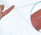 Implantable, Solar-Powered Chip Monitors Blood Sugar Levels