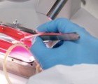 Scientists Use 3D Printer to Create First “Printed” Human Vein