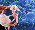 iPod-Sized HIV Detector to Bring Affordable Testing to Rural Communities