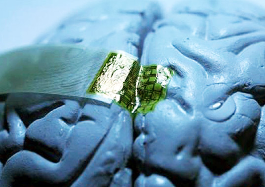 Silk Brain Implant human brain, brain implant, silk, epilepsy, health, green design, design for health, sustainable design