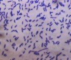 Three-Inch Device Detects 3,000 Types of Viruses and Bacteria