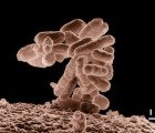 E. coli Bacteria Could Be the Next Source for Cheaper Biofuels