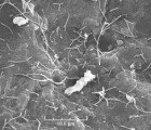 Colorado Startup Uses Coal-Eating Bacteria to “Grow” Natural Gas