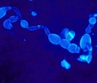 Genetically Modified Bacteria Can Fix Cracked Concrete