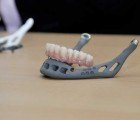 83-Year-Old Woman Gets the World’s First 3D Printed Replacement Jaw