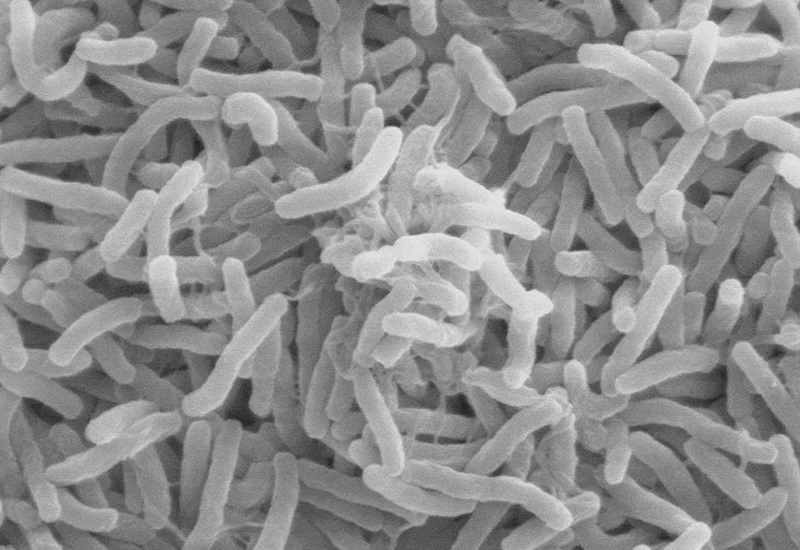umass amherst, nanotechnology, nanotech, all natural nanotech, green nanotechnology, all natural, nanotechnology, nanotechnology developments, nanotechnology discoveries, green technology, sustainable technology, eco technology, clean technology