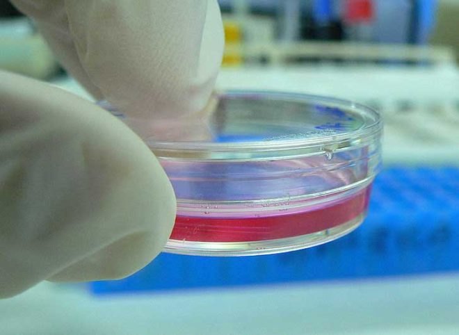 lab mice, stem cells, neurons grown from stem cells, stem cell therapy, stem cell research, stem cell growth, animal rights, animal cruelty, lab animals, lab research, animal research, neuron therapy, stem cell uses, university of wisconsin, madison, cellular dynamics international