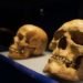 University of Tennessee’s Forensic Anthropology Center, white skulls, medical advances, calorie in-take, skull growth, lifestyle change, fat america