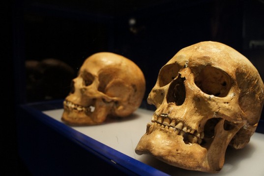University of Tennessee’s Forensic Anthropology Center, white skulls, medical advances, calorie in-take, skull growth, lifestyle change, fat america