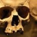University of Tennessee’s Forensic Anthropology Center, white skulls, medical advances, calorie in-take, skull growth, lifestyle change, fat america