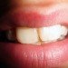 Bacillus licheniformis, tooth decay, seaweed, Newcastle University, green design, eco design, sustainable design