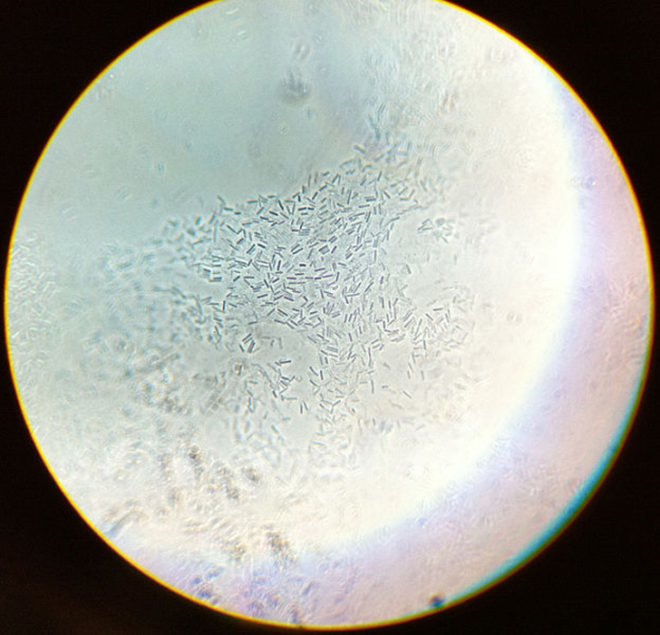biofuel, plane, jet fuel, biodiesel, chemical process, uc berkeley, Clostridium acetobutylicum