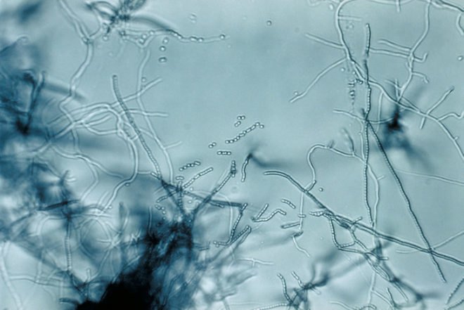 Lignin, bacteria, microbes, biofuels, Brown University, ethanol, algae, grasses, cellulose, alternative fuels,