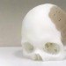 oxford performance materials, prosthetic, skull, 3d printer, technology, additive manufacturing, pekk, replacement