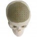 oxford performance materials, prosthetic, skull, 3d printer, technology, additive manufacturing, pekk, replacement