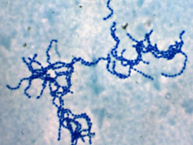 University of Oxford, Superglue, Flesh-eating bacteria, Streptococcus pyogenes, necrotizing fasciitis, science, design for health, early cancer detection, chemical bond