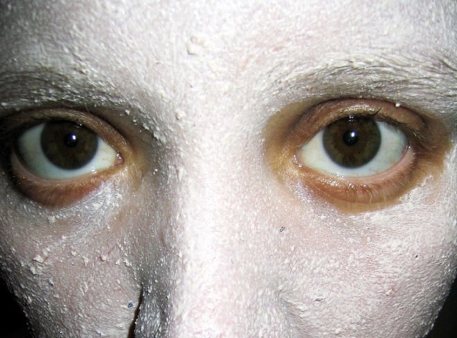 Facial moisture mask