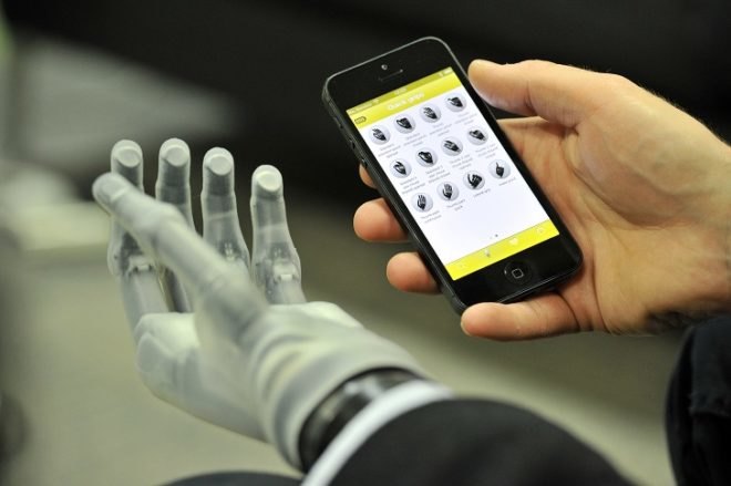 Touch Bionics, i-Limb Ultra prosthetic hand, prosthetics, smart phone apps, artificial limbs, innovative technology, prosthetic device, prosthetic technology, artificial skin