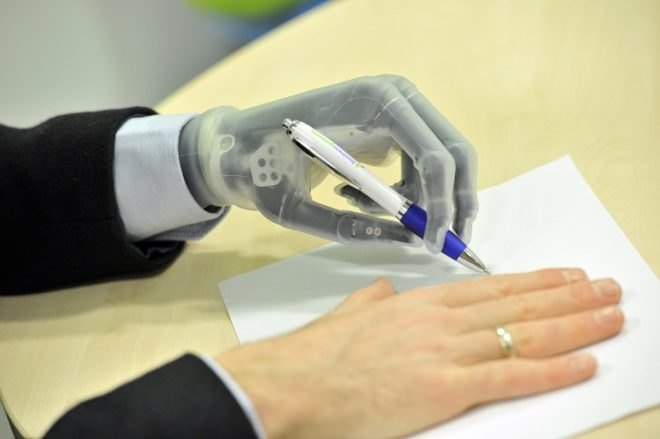 Touch Bionics, i-Limb Ultra prosthetic hand, prosthetics, smart phone apps, artificial limbs, innovative technology, prosthetic device, prosthetic technology, artificial skin