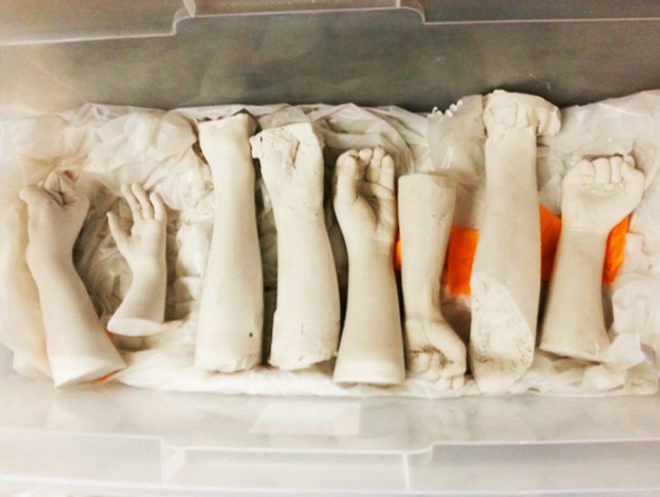 KIDmob Helps Superhero Cyborg Kids Prototype Their Own Prosthetics