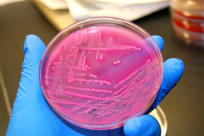 Imperial College London, Escherichia coli, E coli, bacteria, propane, low emission fuels, LPG, science, scientific breakthrough, scientists make propane from E coli bacteria, Patrik Jones