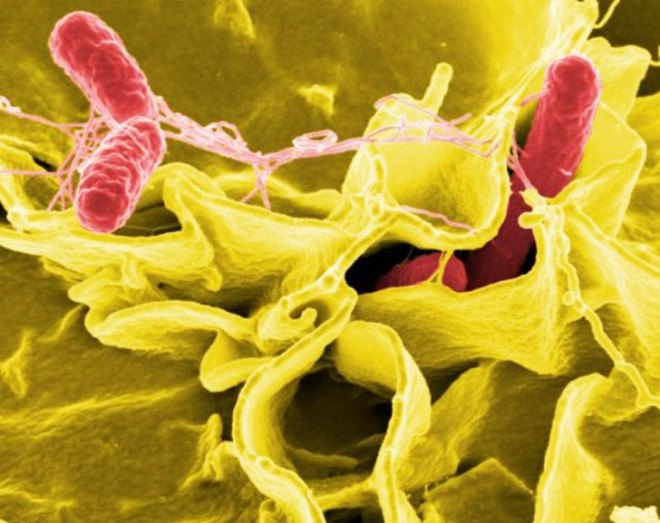 bacteria, CDC, bacteria resistance, antibiotics, antibiotic resistance, superbugs, bacteria illness, single cell, Korean diagnostic test, bacteria diagnostic test, single cell bacteria