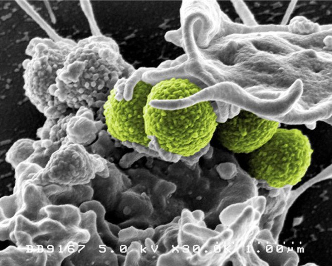 bacteria, CDC, bacteria resistance, antibiotics, antibiotic resistance, superbugs, bacteria illness, single cell, Korean diagnostic test, bacteria diagnostic test, single cell bacteria