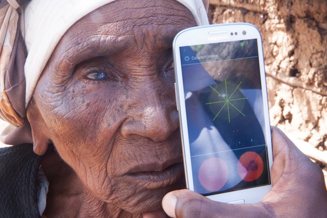 Peek Retina, Design for Health, Design to Improve Life, eco design, green design, humanitarian design, index award winners, index: award, Sustainability, Sustainable Design, world’s biggest design prize, index awards