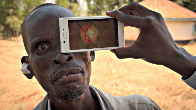 Peek Retina, Design for Health, Design to Improve Life, eco design, green design, humanitarian design, index award winners, index: award, Sustainability, Sustainable Design, world’s biggest design prize, index awards