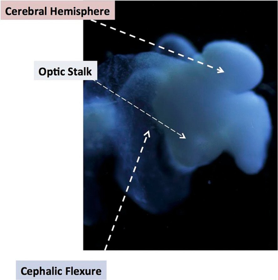 first human brain grown in lab, lab grown human brain, human brain research, 3D-printing human brain, human brain research
