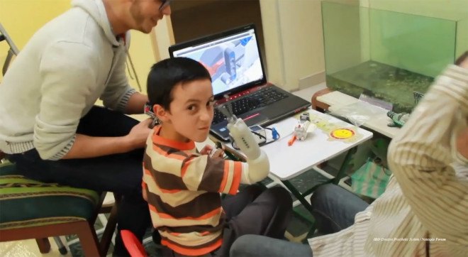 3D printed prosthetics, 3D printing, lego, netexplo, technology, disabilities, 3D prosthetics, medical technologies, design competitions, design for health, innovation