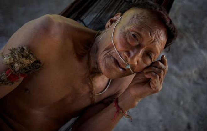 peru, mercury, mercury poisoning, amazon tribe, peruvian amazon tribe, indigenous people, mercury poisoning epidemic peruvian tribe, camisea gas project, health, amazon