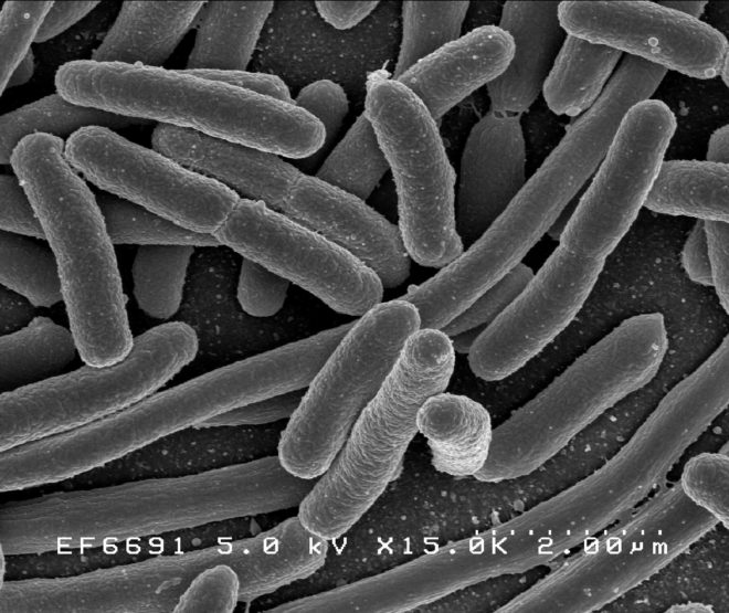 E Coli, Escherichia coli, E coli micrograph