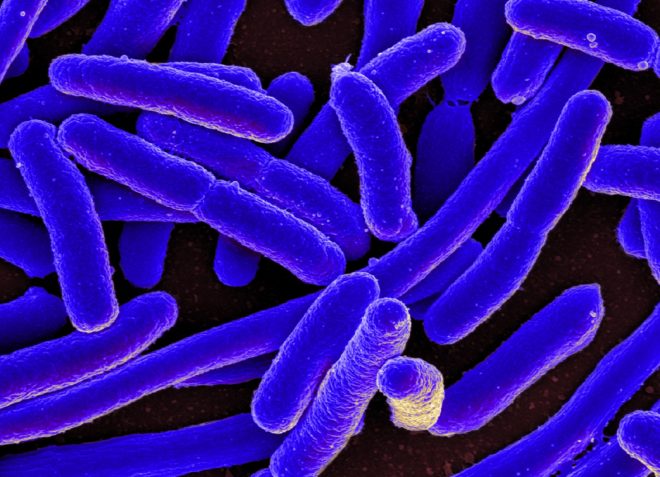 E Coli, Escherichia coli, E coli micrograph