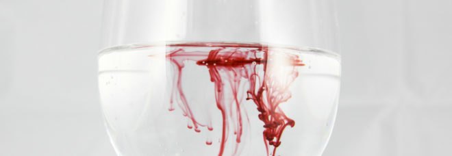 laser technology, medical technology, blood lasers, university of michigan, tumors, medical lasers, lasers to detect tumors