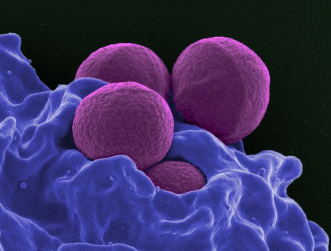 superbugs, antibiotics, antibiotic resistant bacteria, mrsa, shu lam, university of melbourne, microbiology, polymers, snapps, antibiotic resistance, superbug solutions
