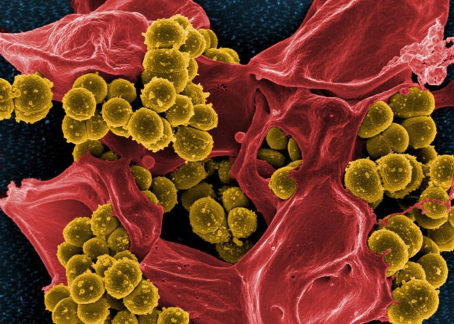 superbugs, antibiotics, antibiotic resistant bacteria, mrsa, shu lam, university of melbourne, microbiology, polymers, snapps, antibiotic resistance, superbug solutions