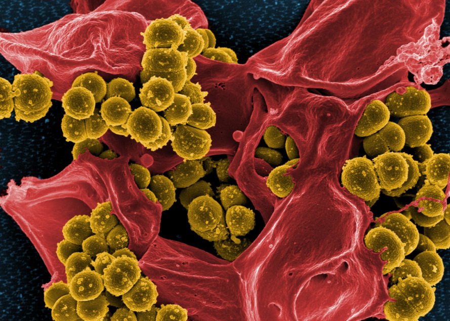 superbugs, antibiotics, antibiotic resistant bacteria, mrsa, shu lam, university of melbourne, microbiology, polymers, snapps, antibiotic resistance, superbug solutions
