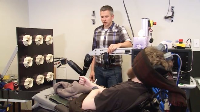 robotics, prosthetics, prosthesis, robotic arm, prosthetic arm, brain implant, brain electrodes, physical touch, university of pittsburgh medical center, upmc, robotics research, brain research