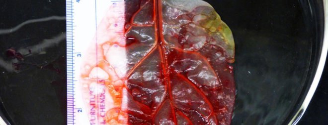 spinach, Worcester Polytechnic Institute, cardiology, biomedical engineering, human tissue regeneration