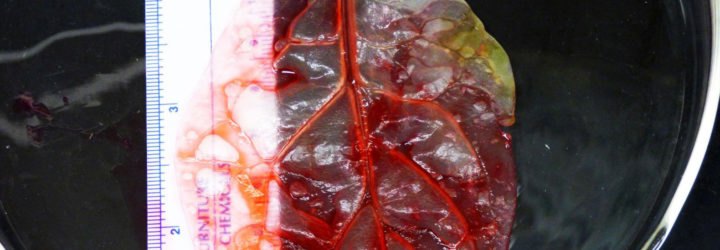 spinach, Worcester Polytechnic Institute, cardiology, biomedical engineering, human tissue regeneration