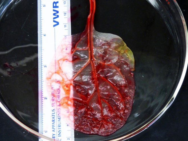 spinach, Worcester Polytechnic Institute, cardiology, biomedical engineering, human tissue regeneration