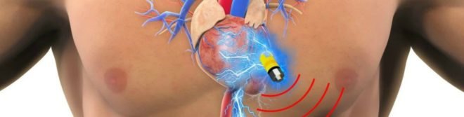 UCLA, energy, battery, Supercapacitor, longevity, University of Connecticut