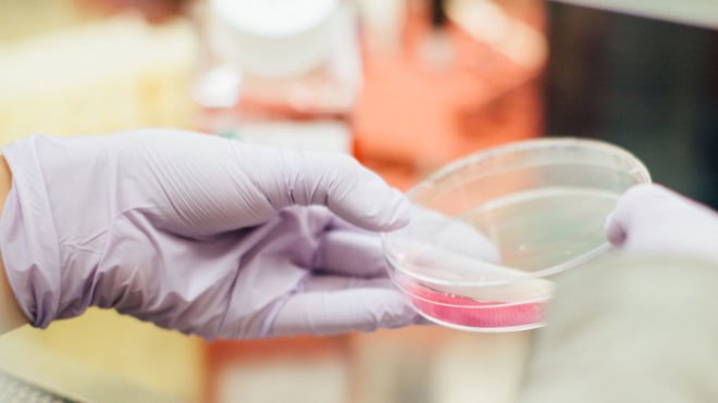 Houston, superbugs, Houston Methodist Research Institute, pneumonia, K. pneumoniae, germs, public health