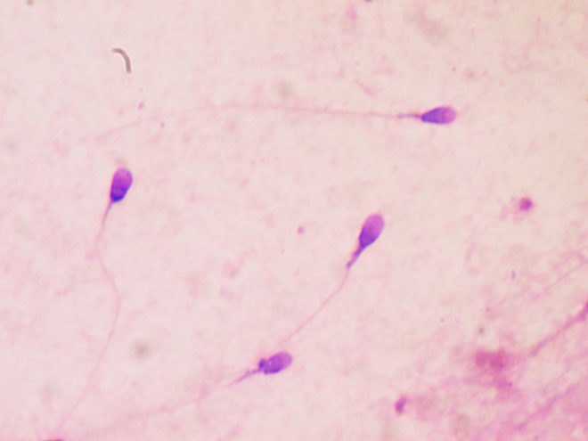 Sperm, human sperm, sperm count, sperm concentration, human reproduction, Human Reproduction Update, reproduction, extinct, extinction, human extinction, health, science