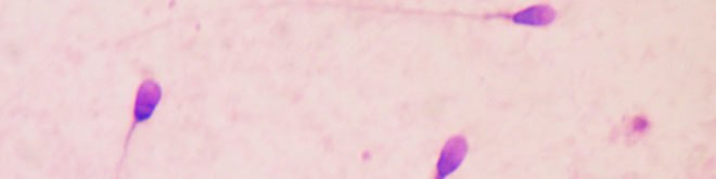 Sperm, human sperm, sperm count, sperm concentration, human reproduction, Human Reproduction Update, reproduction, extinct, extinction, human extinction, health, science
