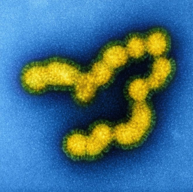 H1N1 flu, H1N1 swine flu, H1N1 microscope
