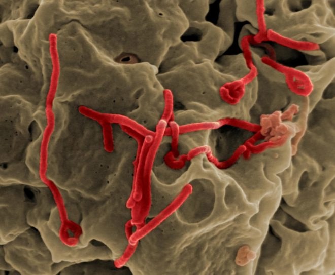 ebola, ebola virus, ebola microscope