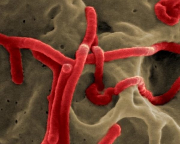 ebola, ebola virus, ebola microscope